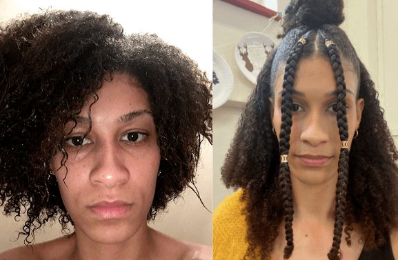 Mum's struggle with psoriasis inspires natural products for black hair -  Voice Online